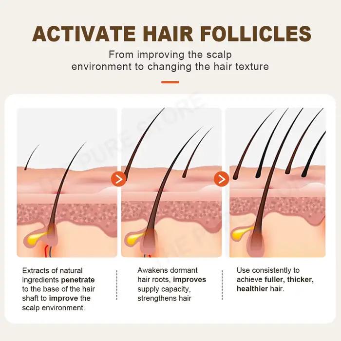 PURC – shampoing au gingembre, traitements contre la perte de cheveux, nourrissant, lissant, épaissi