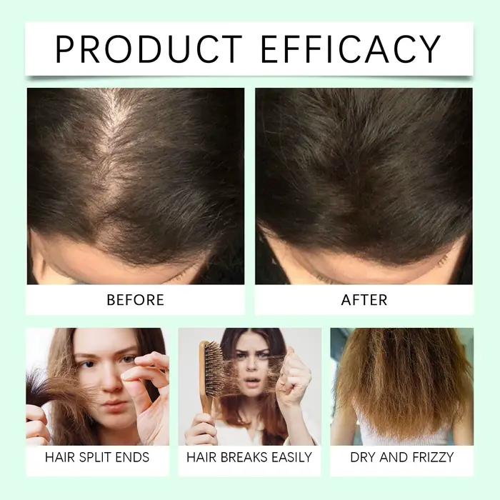 Huile essentielle de romarin pour cheveux, traitement de renforcement du cuir chevelu et des cheveux pour amincir, nourrit les cheveux secs et répare les pointes fourchues