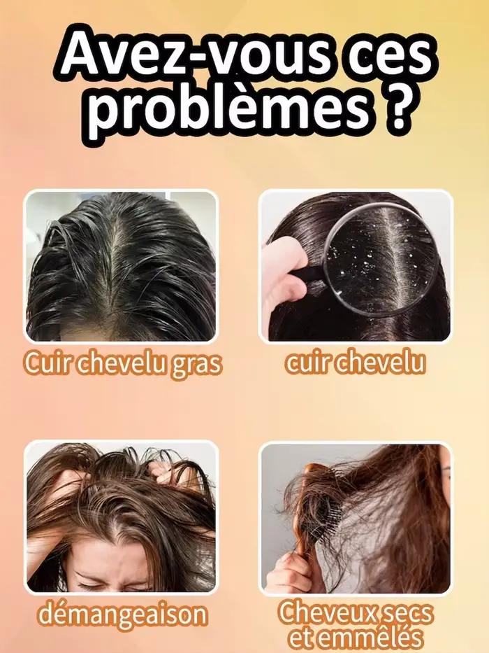 Shampoo antipelliculaire au soufre pour tous types de cheveux