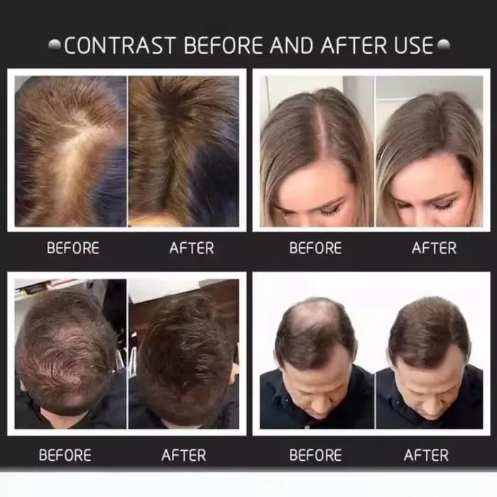 Nouvelle Fiber de renforcement des cheveux