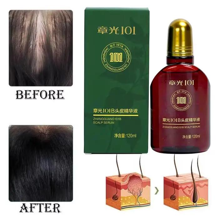 Lotion pour cheveux du cuir chevelu, 120ml, Essence de Ginseng et de gingembre, liquide, revitalisan