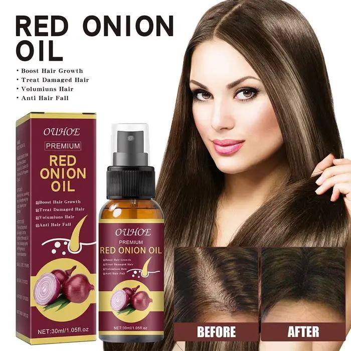 Spray d'huile essentielle d'oignon rouge pour les soins capillaires, Spray capillaire hydratant à l'