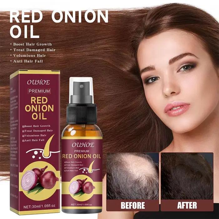 Spray d'huile essentielle d'oignon rouge pour les soins capillaires
