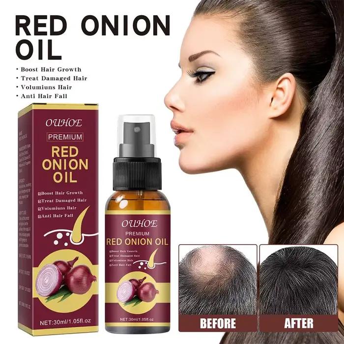 Spray d'huile essentielle d'oignon rouge pour les soins capillaires