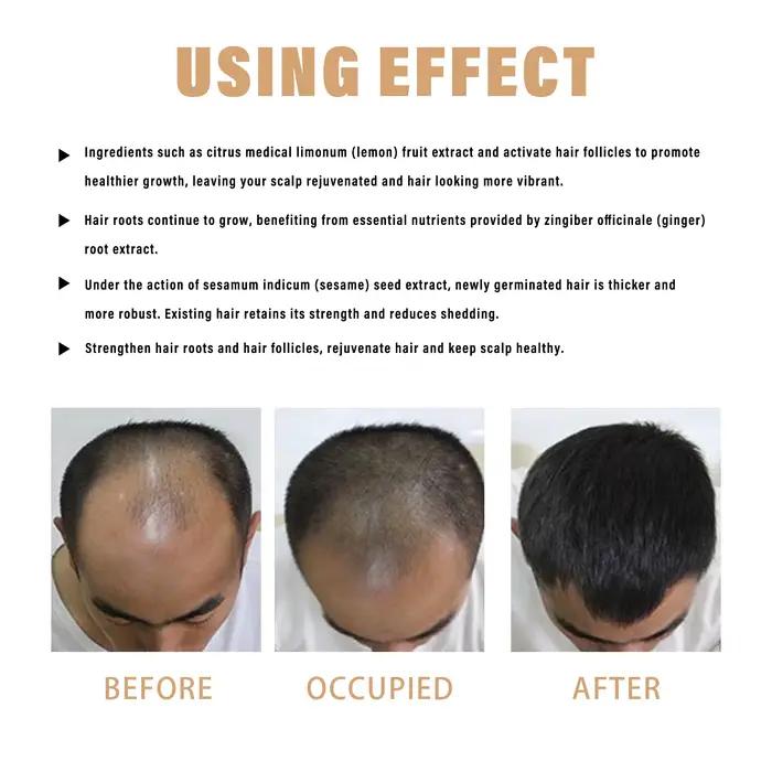Shampoo densifiant pour cheveux 100 ml