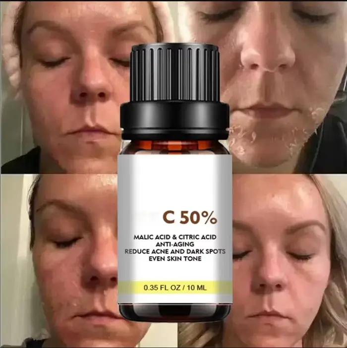 Huile exfoliante pour les taches de peau foncées