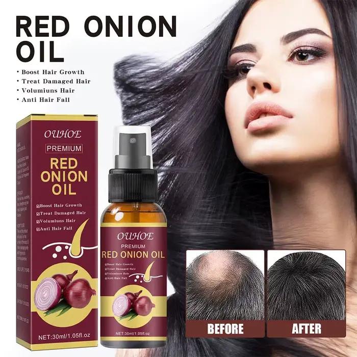 Spray d'huile essentielle d'oignon rouge pour les soins capillaires